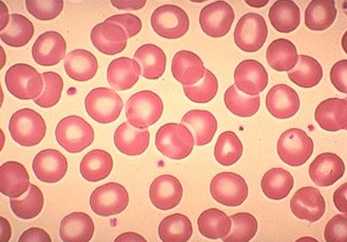 Glbulos rojos en sangre humana