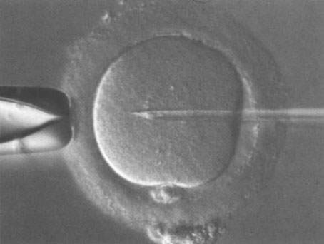 Fecundacin "in vitro" de un vulo.