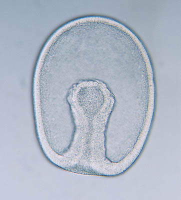 Gstrula
