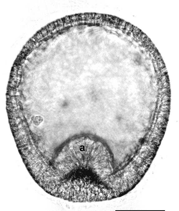 Inicio de gstrula, formndose el arqunteron