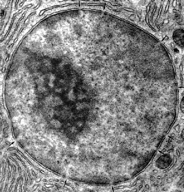 Ncleo de clula eucariota, con el nucleolo a su izquierda, lugar donde se encuentra una gran concentracin de precursores de ARN.