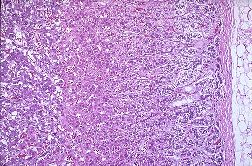 cpsulas suprarrenales al microscopio