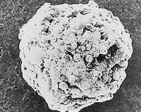 Clula cancerosa de ovario. Tomada de wwwspacedailycom