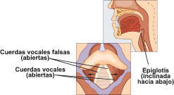 epiglotis