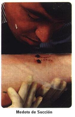 Succi�n