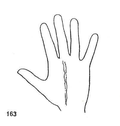 L�neas Secundarias