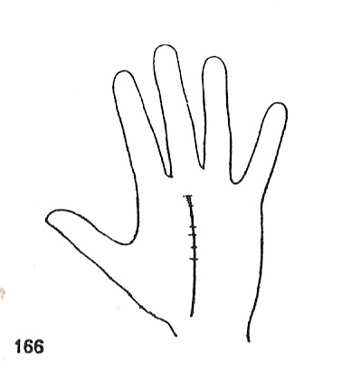 L�neas Secundarias