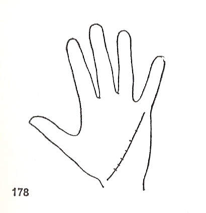 L�neas Secundarias