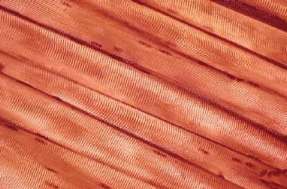 Tejido muscular estriado. Las células son largas y cilíndricas, denominándose fibras. Observa la estriación que presentan las fibras.