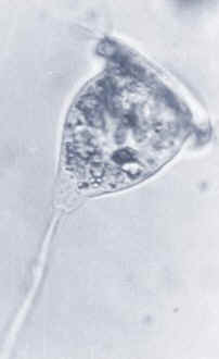 Vorticella es un protozoo sésil, es decir, fijo a un sustrato