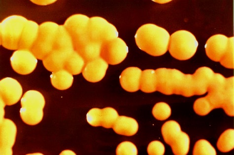 Los cocos son bacterias redondeadas