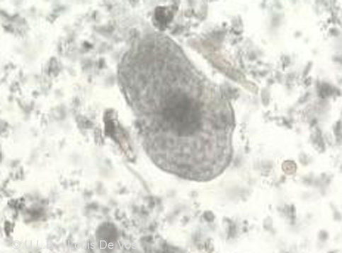 Entamoeba Histolytica