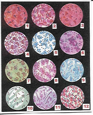 Observación de distintas bacterias a microscopía óptica