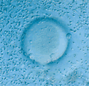 vulo